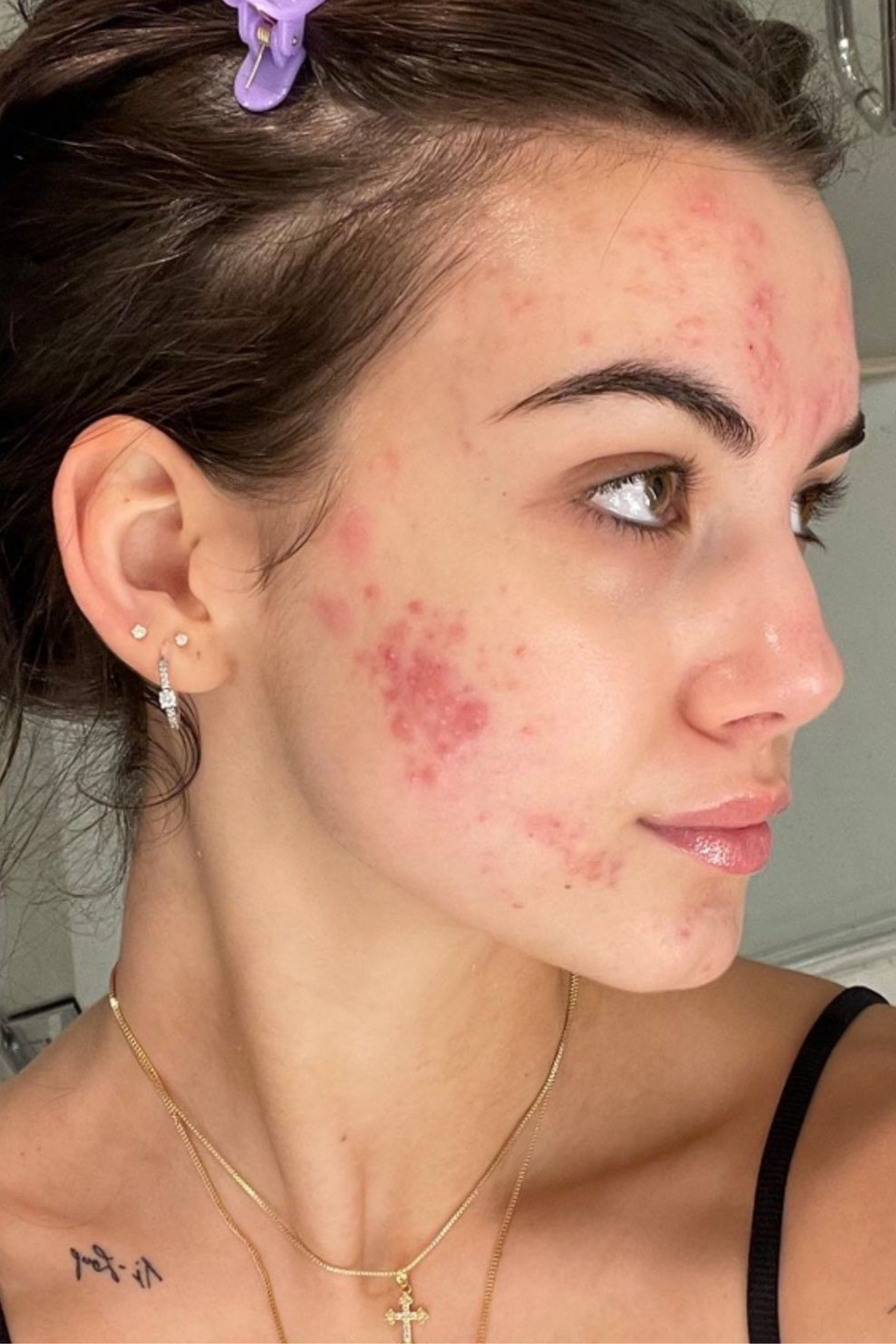 Vital Acres skincare timeline